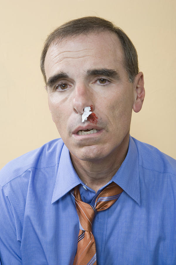Studio portrait of man with bloody nose Photograph by Sheer Photo, Inc