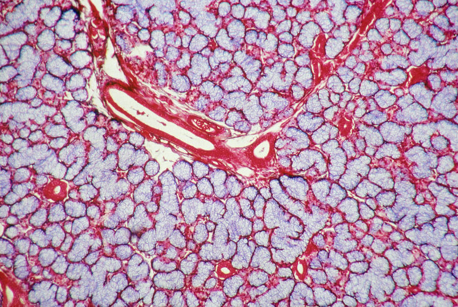 Sublingual Salivary Gland Lm Photograph by John Watney