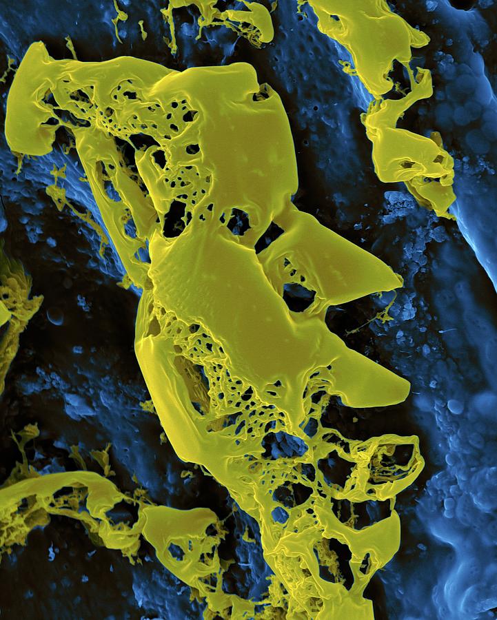 Match Photograph - Sulphur From A Volcanic Steam Vent by Dennis Kunkel Microscopy/science Photo Library
