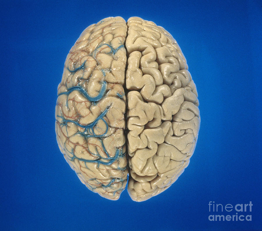 Superior View Of Brain Photograph by David Bassett