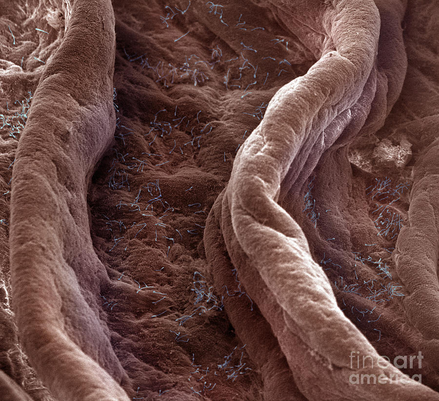 Surface Of Human Vagina Photograph by David M. Phillips