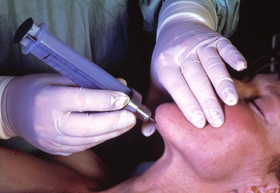 Liposuction Photograph - Surgeon Conducting Liposuction On Patients Chin by Pascal Goetgheluck/science Photo Library