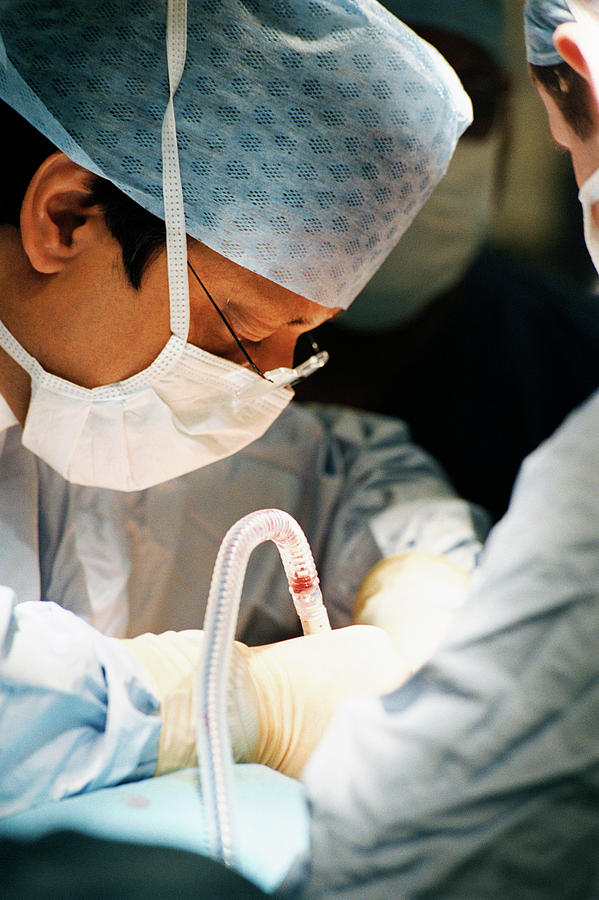 Surgeon Performing Mastectomy Photograph by Mark Thomas/science Photo ...