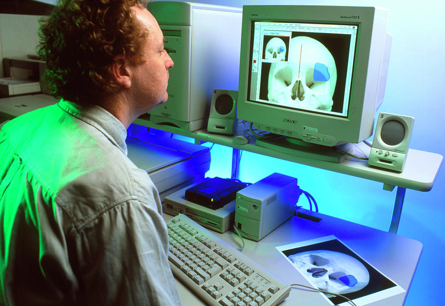 Surgeon Planning A Brain Operation On A Computer Photograph by Science Photo Library