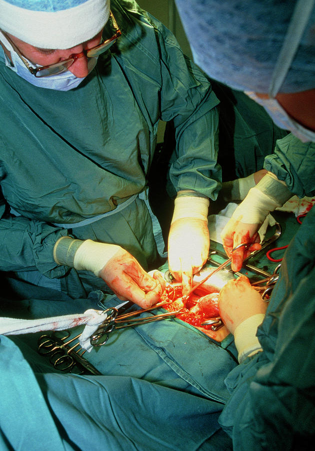Surgeons Performing A Hysterectomy Operation Photograph by Antonia Reeve/science Photo Library
