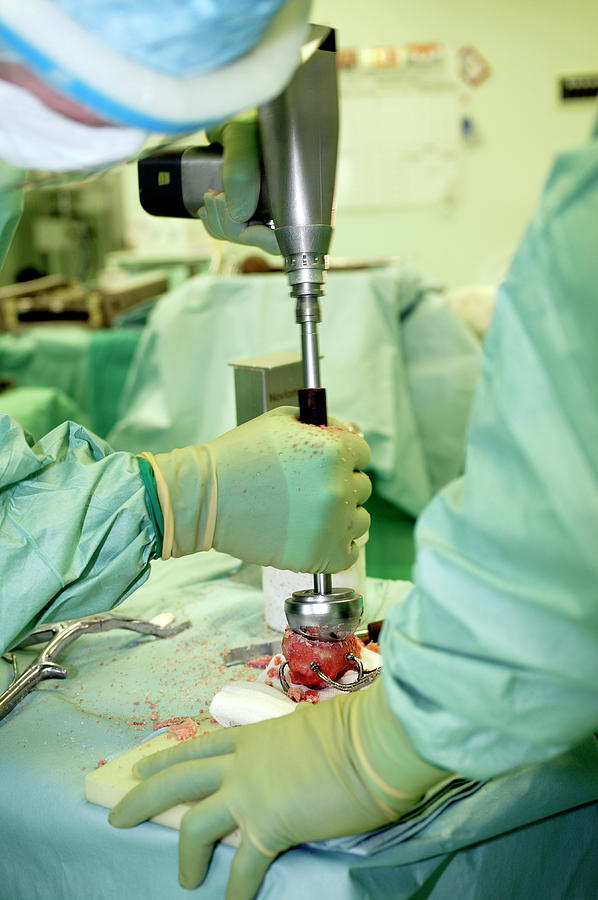 Surgery To Remove A Tumour In The Pelvis Photograph by Antonia Reeve/science Photo Library