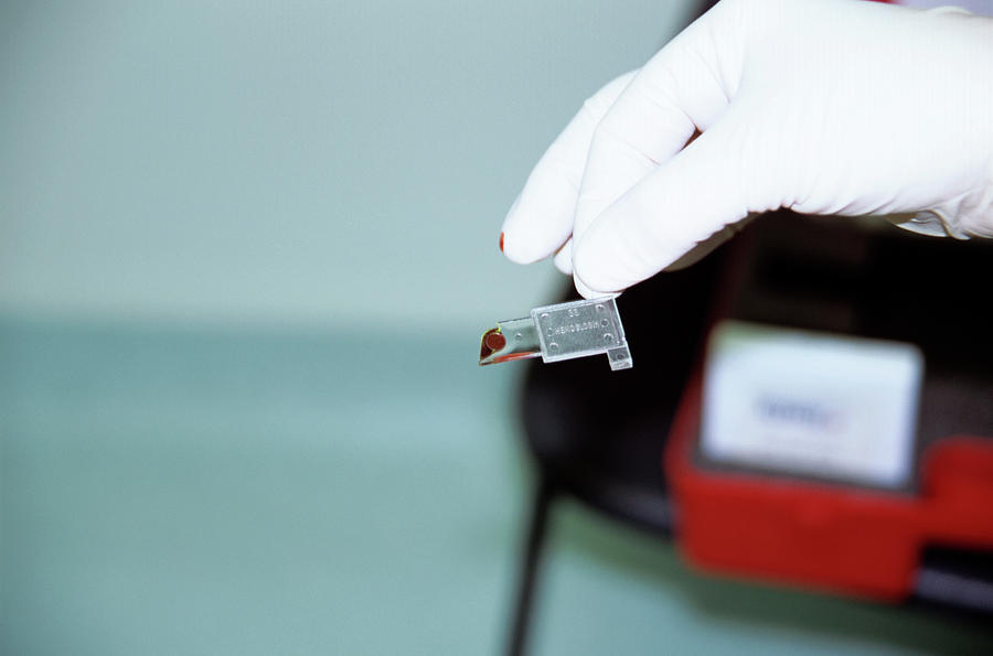 Surgical Blood Test Photograph by Antonia Reeve/science Photo Library