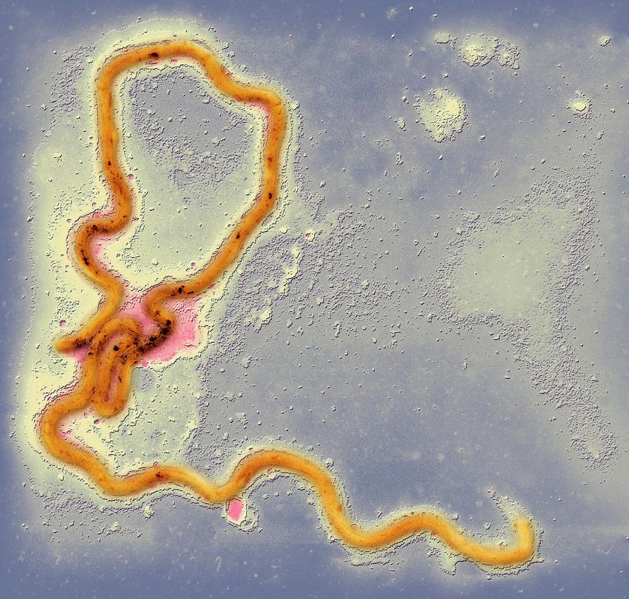 Syphilis Bacterium Photograph by Ami Images/science Photo Library