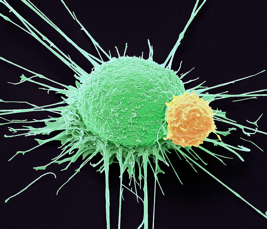 T Lymphocyte And Cancer Cell Photograph by Steve Gschmeissner