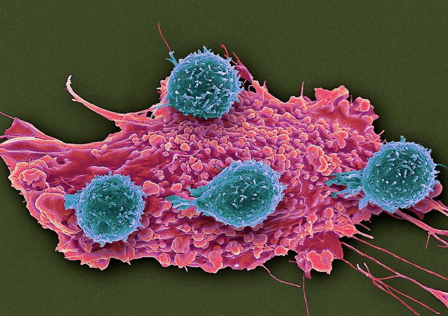 T Lymphocytes And Cancer Cell Photograph by Steve Gschmeissner