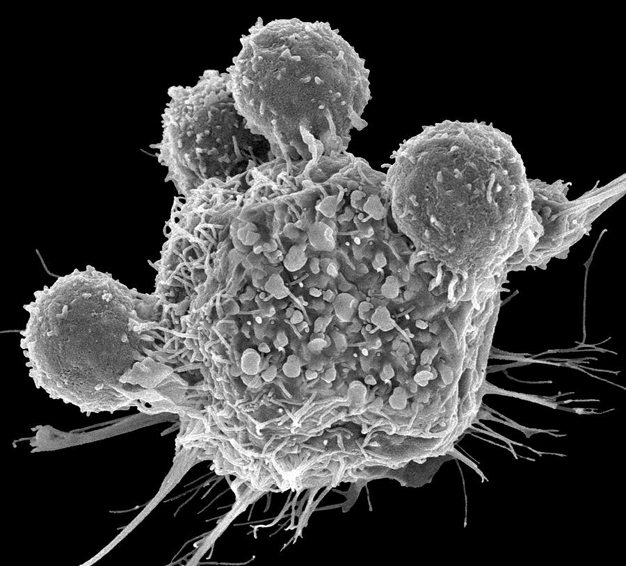 T Lymphocytes And Cancer Cell Photograph by Steve Gschmeissner/science Photo Library