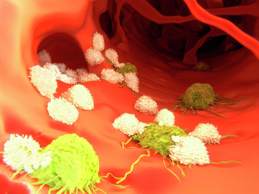 T-lymphocytes And Cancer Cells, Artwork Photograph by Juan Gaertner