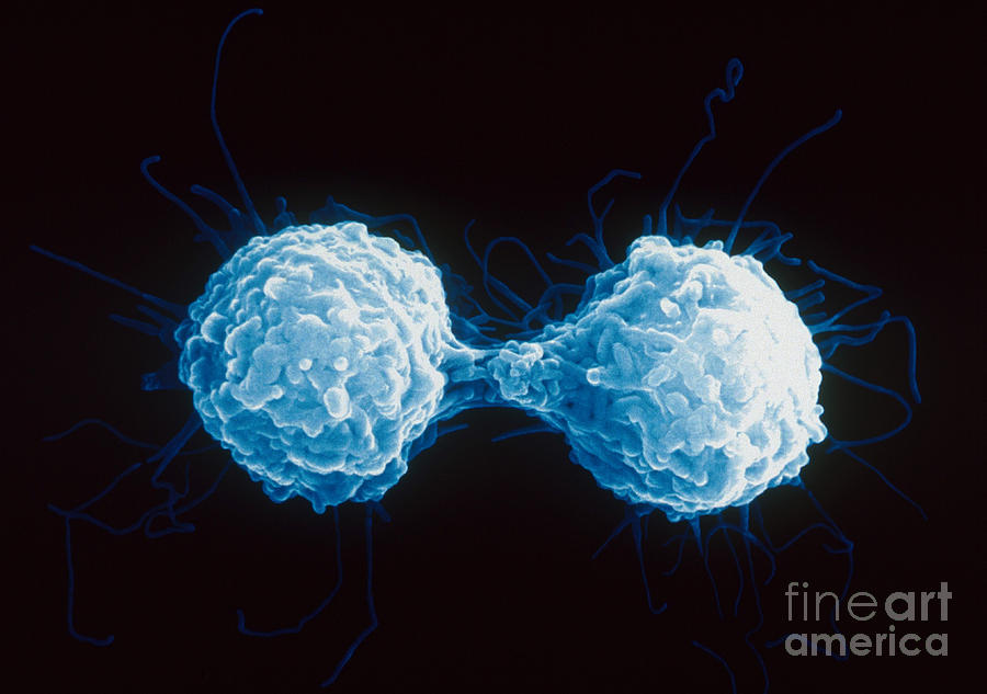 T-lymphocytes Sem Photograph by Stem Jems