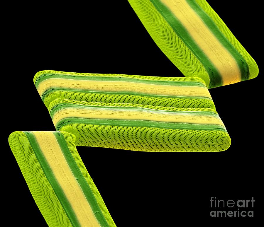 Nature Photograph - Tabellaria Diatoms, Sem by Steve Gschmeissner