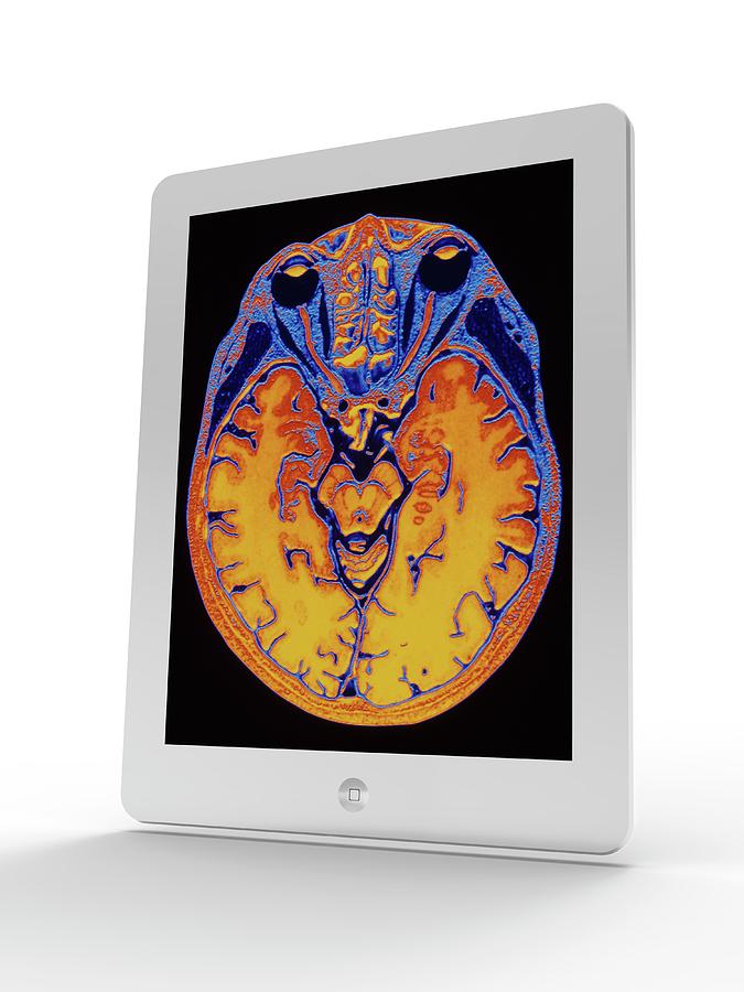 Tablet Computer Showing Mri Brain Scan Photograph By Alfred Pasieka