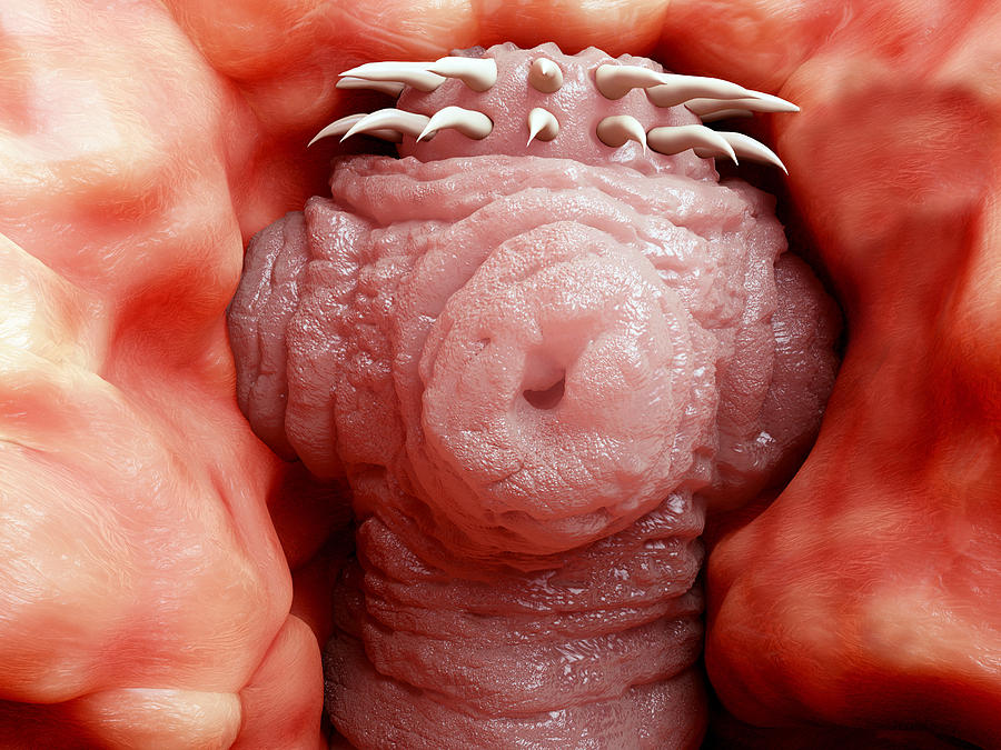 Tapeworm Head Attached To The Intestine Photograph by Juan Gaertner