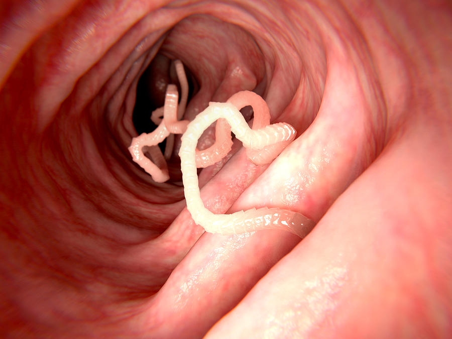 Tapeworm In Human Intestine Photograph by Juan Gaertner