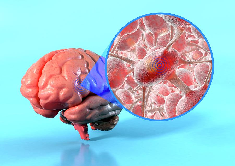 Targeted Psychological Treatments Photograph by Animated Healthcare Ltd/science Photo Library