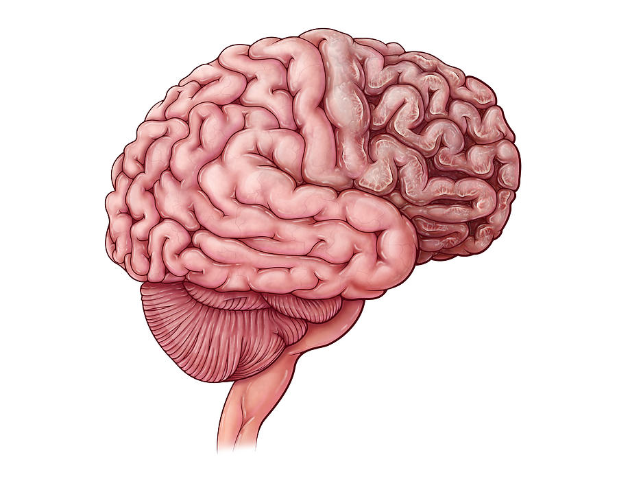 Tay-sachs Disease, Illustration Photograph by Evan Oto - Pixels