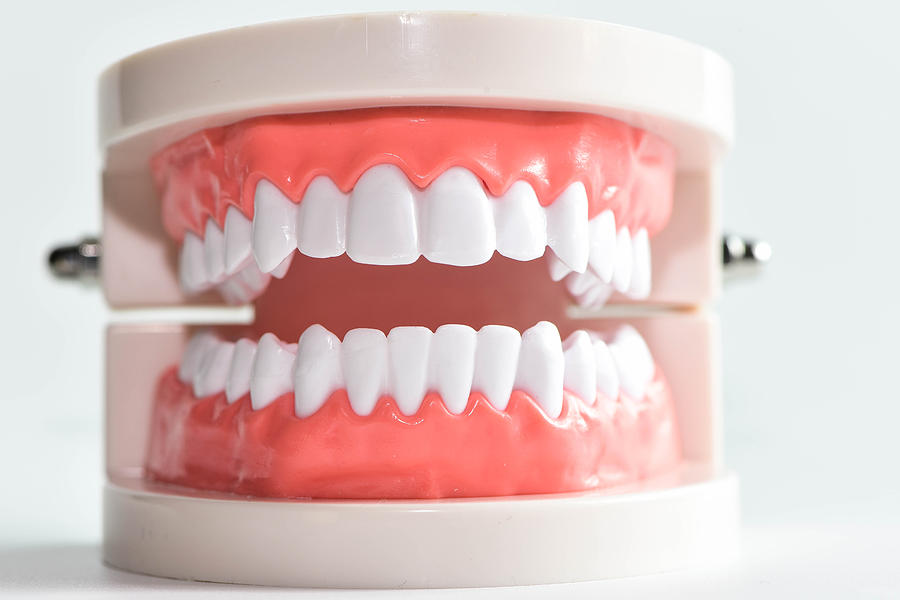 Teeth and Dental instrument Photograph by Somchai um-im