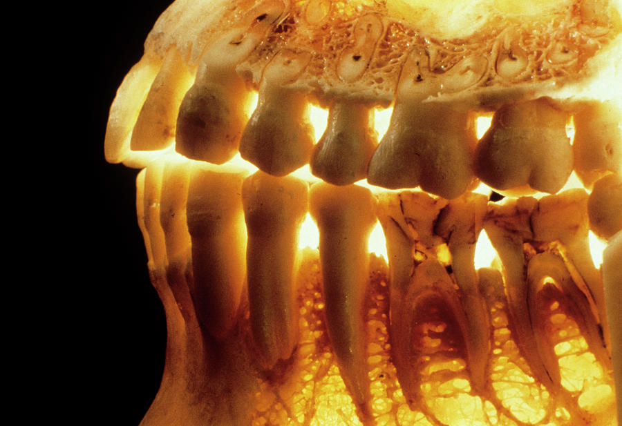 Teeth In The Jaws Photograph by Alain Pol, Ism/science Photo Library