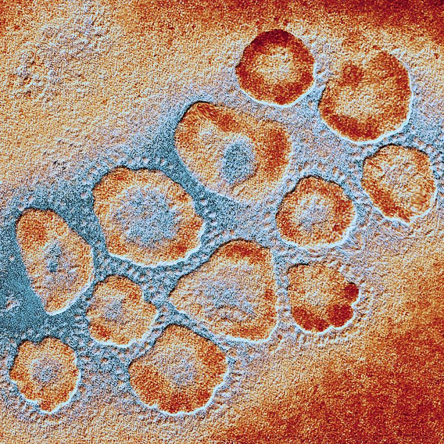 TEM of a cluster of corona viruses Photograph by Pasieka