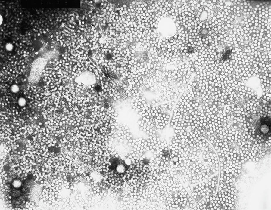 Tem Of Adenovirus & Parvovirus Particles Photograph by C.r. Madeley/science Photo Library