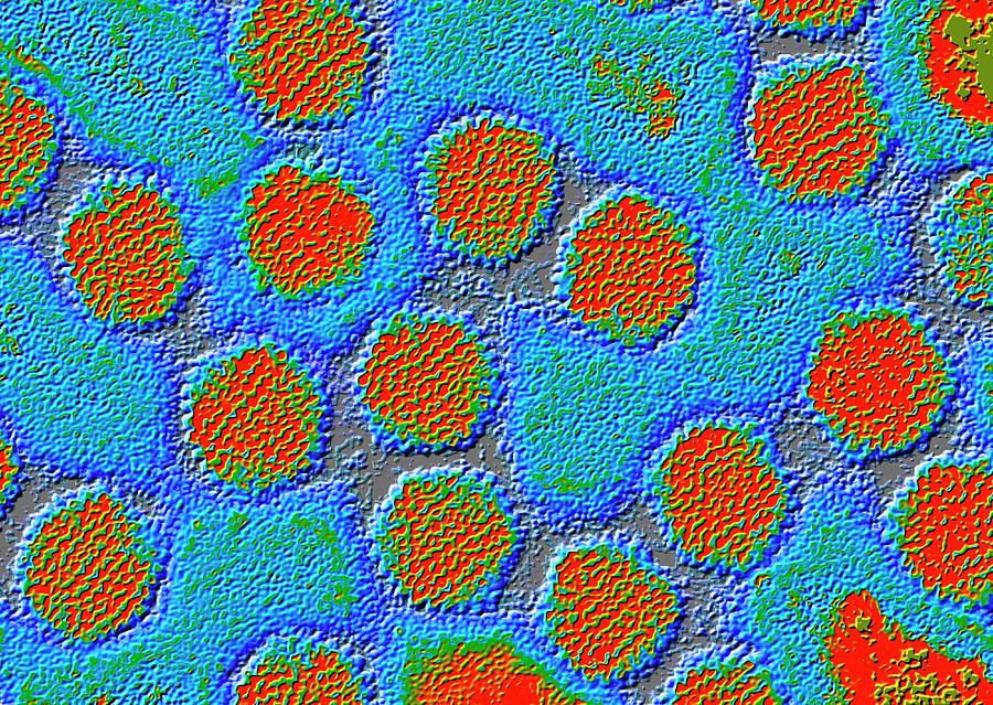 Tem Of Adenoviruses Photograph by Alfred Pasieka/science Photo Library