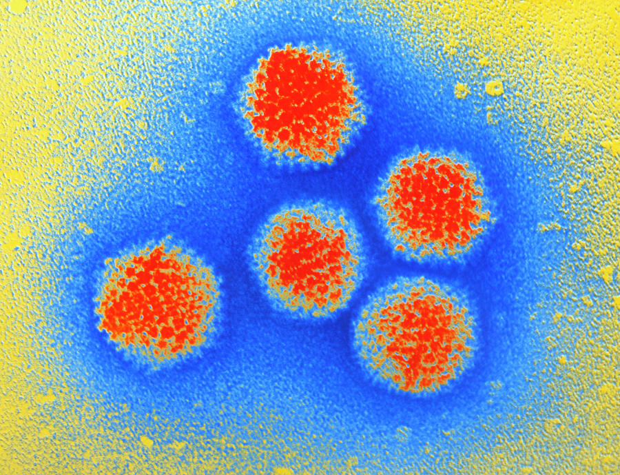 Tem Of Adenoviruses Photograph by M. Wurtz/biozentrum, University Of Basel/ Science Photo Library