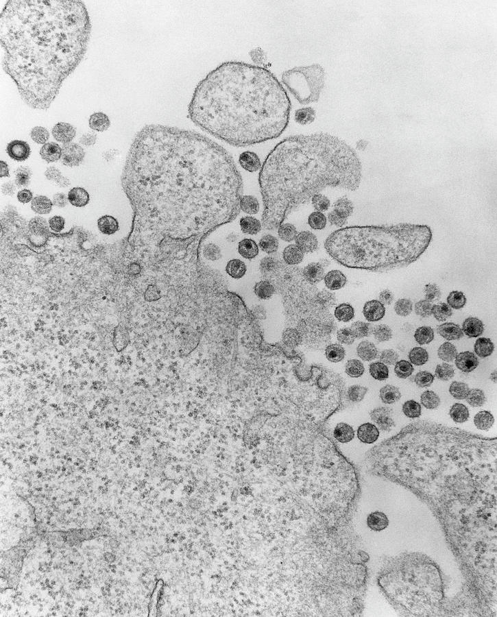 Tem Of Aids Virus Particles Around Infected T-cell Photograph by University Of Medicine & Dentistry Of New Jersey/science Photo Library