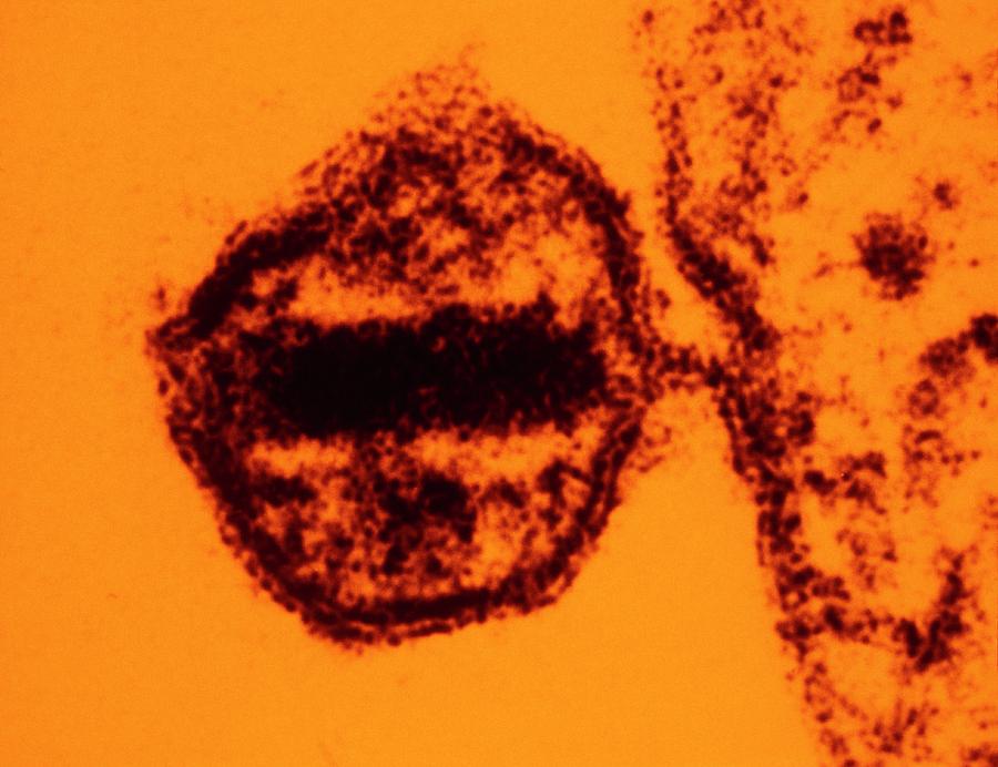 Tem Of Aids Virus Photograph by U.s. National Cancer Institute/science Photo Library.