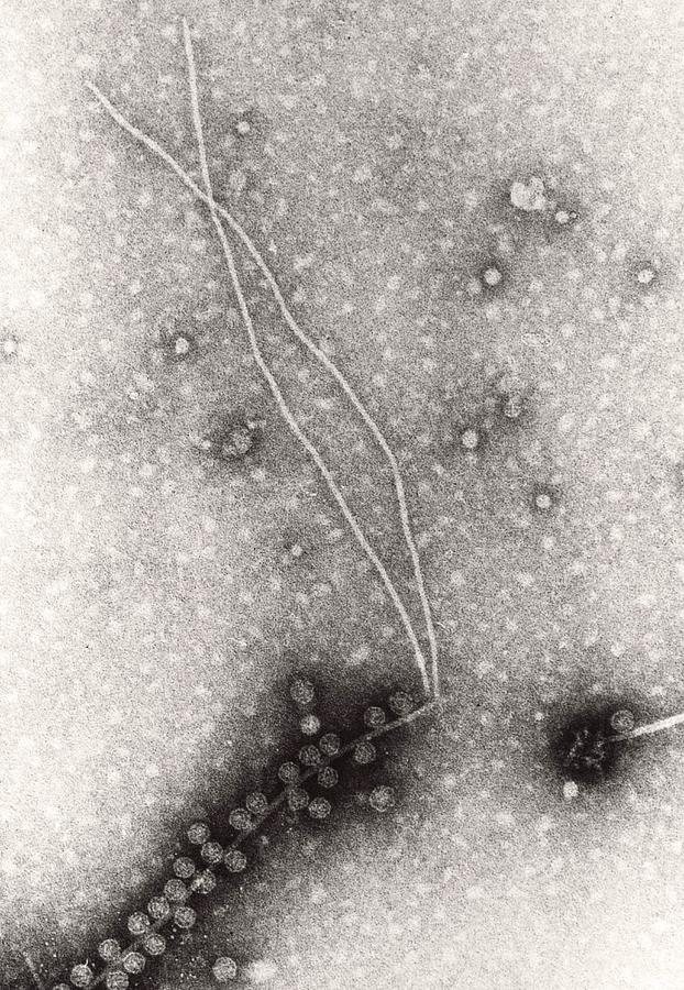 Virus Infection Photograph - Tem Of Bacteriophages F1 & F2 On Pilus Of E. Coli by Prof. L. Caro/science Photo Library