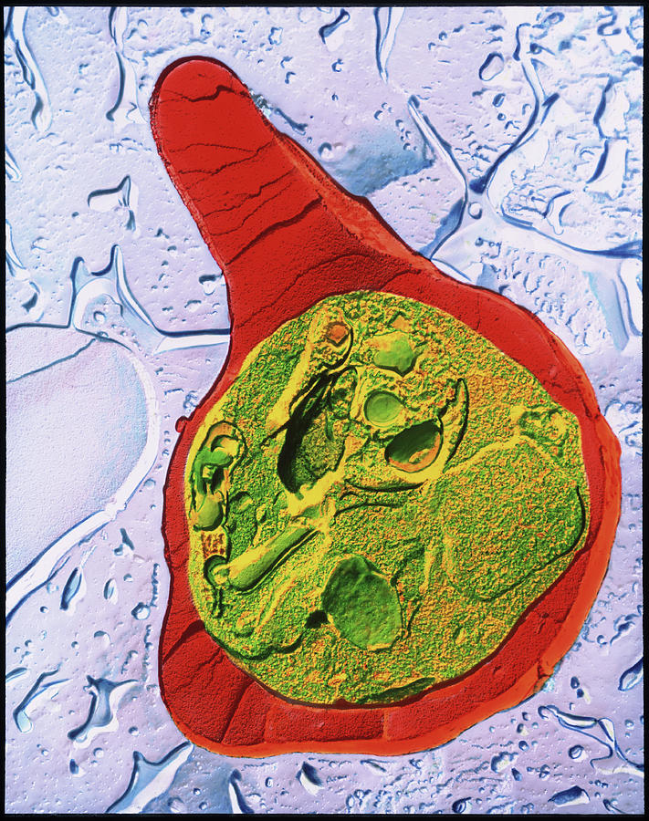Tem Of Blood Cell With Malaria Photograph by Dr Tony Brain/science ...