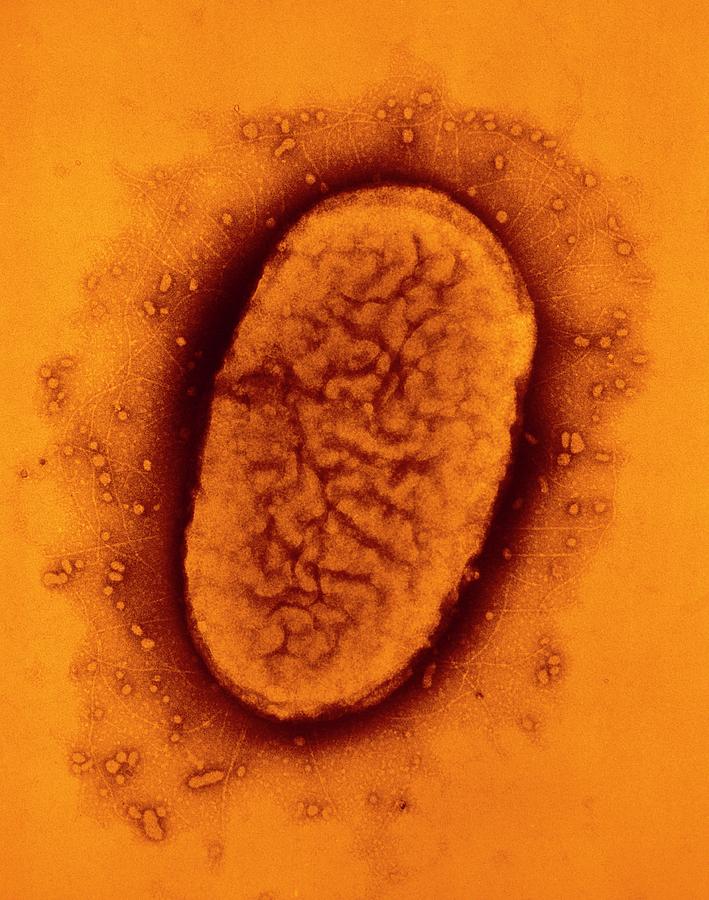 Tem Of Bordetella Pertussis Bacterium Photograph by A. Dowsett, Public