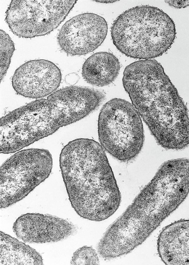 Tem Of E. Coli Bacteria By A. Dowsett, Public Health England/science ...