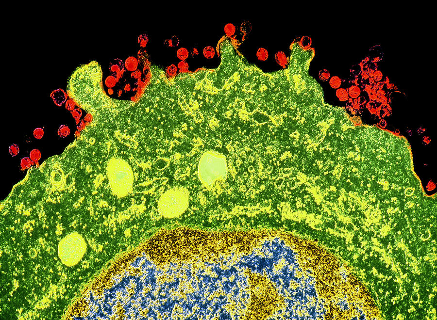 Tem Of Hiv-2 Aids Virus Particles Photograph by University Of Medicine & Dentistry Of New Jersey/science Photo Library