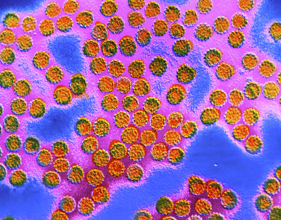 Tem Of Papilloma Viruses Photograph by Cnri/science Photo Library