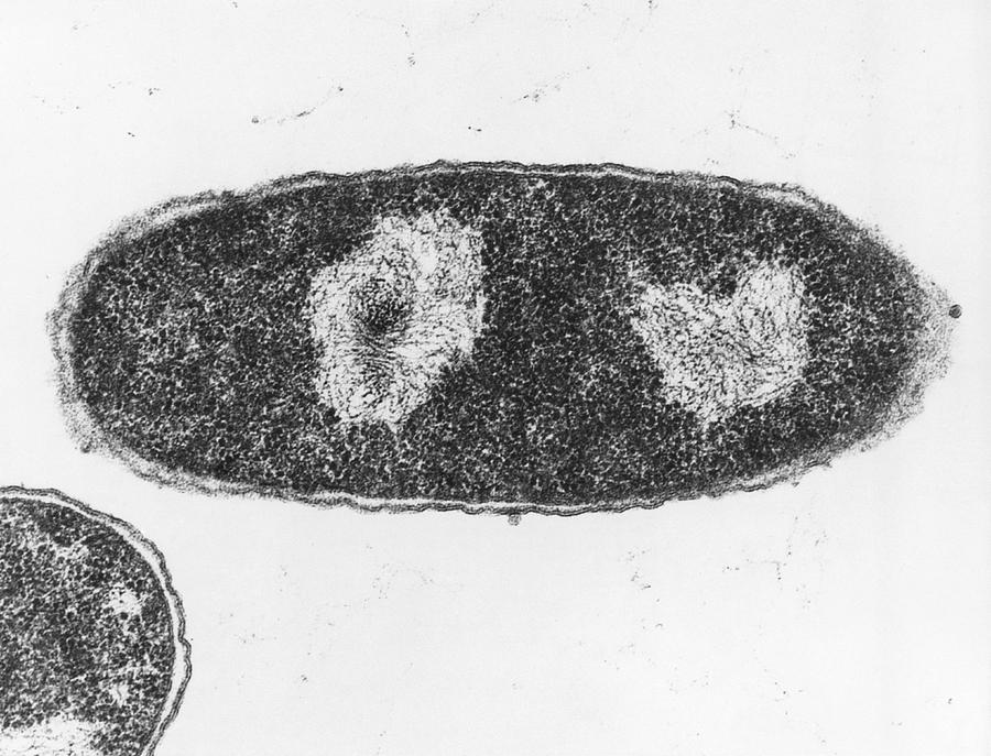 Tem Of The Bacteria Escherichia Coli Photograph by Menge & Wurtz/biozentrm, University Of Basel/science Photo Library.