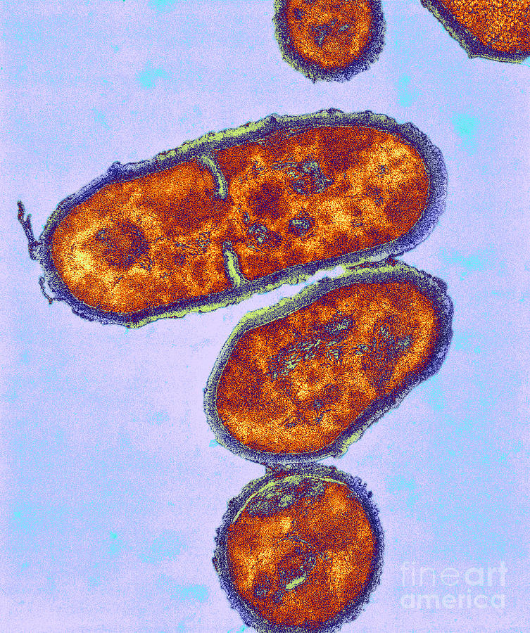 Tem Propionibacterium Acnes Photograph by Kwangshin Kim