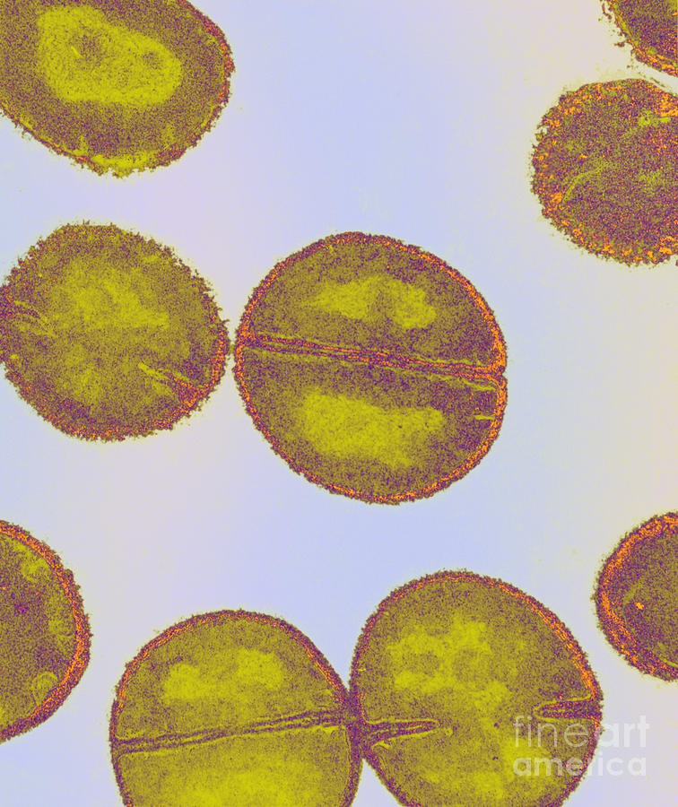 Tem Staphylococcus Aureus Photograph by Kwangshin Kim