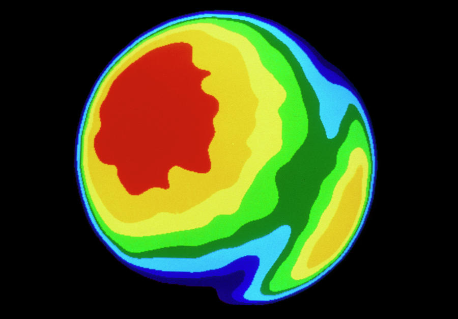 planet mercury surface temperature