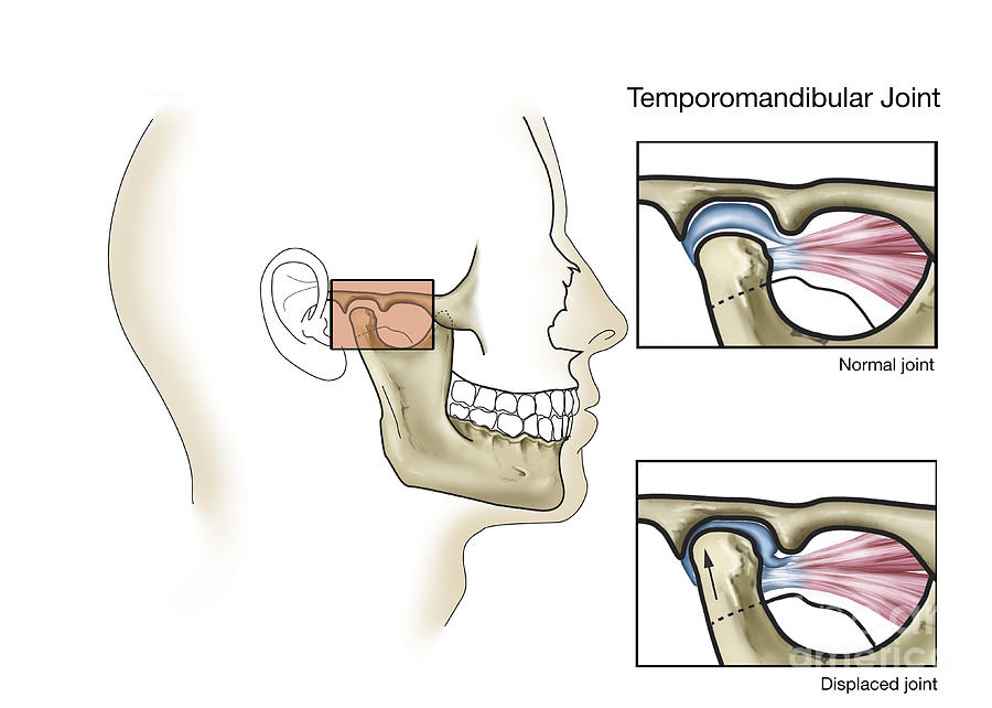 Horizontal Digital Art - Temporomandibular Joint, Normal by TriFocal Communications