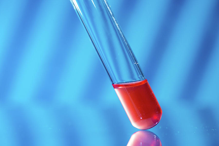 Test Tube With Blood Sample Photograph By Wladimir Bulgar/science Photo ...