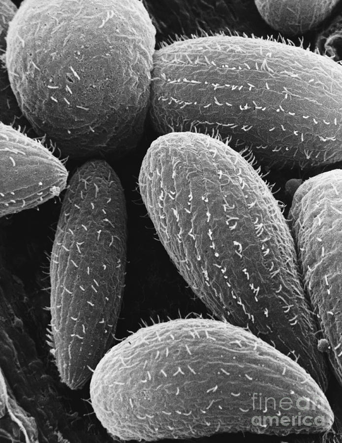 Tetrahymena Ciliate Sem Photograph by David M. Phillips