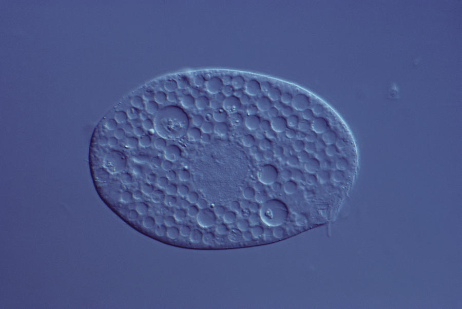 Tetrahymena Pyriformis Photograph by Joaquin Carrillo-Farga