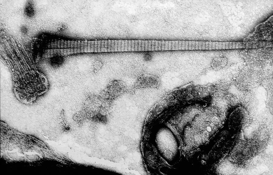 Tetrahymena Pyriformis, Tem Photograph by Greg Antipa
