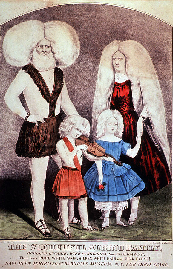 The Wonderful Lucasie Albino Family Photograph by Science Source