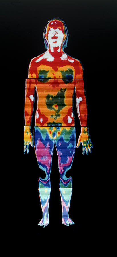 Thermogram Of A Man Photograph by Dr Ray Clark (frps) & Mervyn De Calcina- Goff (frps)/science Photo Library