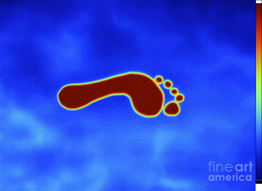 Thermogram Of Footprint Photograph by GIPhotoStock