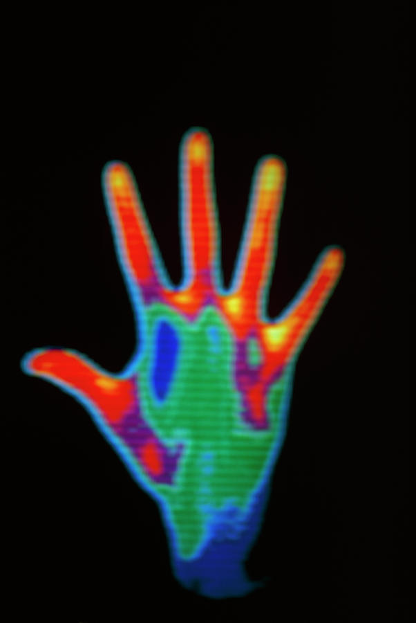 Thermograph Of Man's Hand Showing Palm Upward by Williams